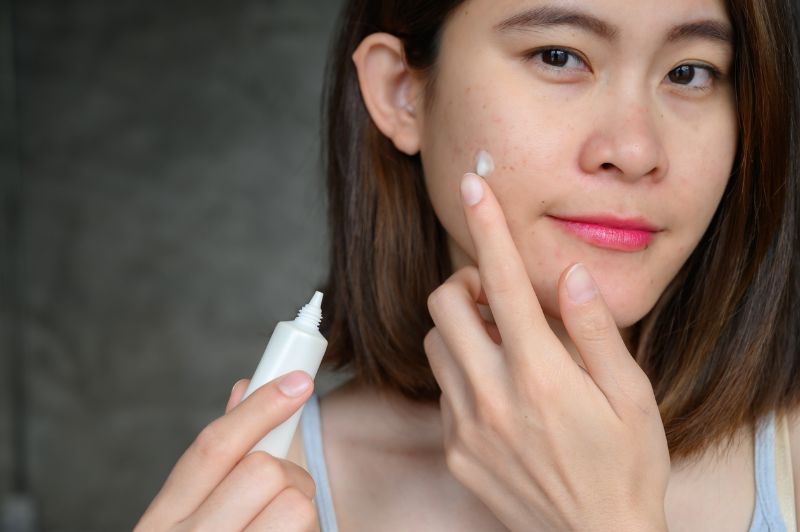 Acne Cream